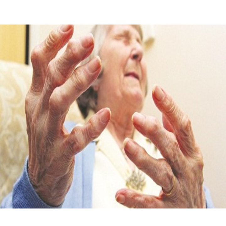 Viêm khớp dạng thấp