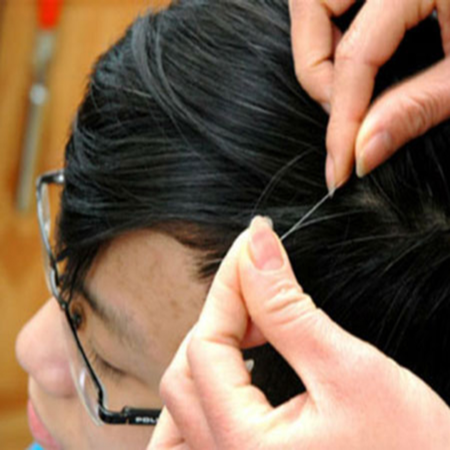 Chữa tóc bạc sớm