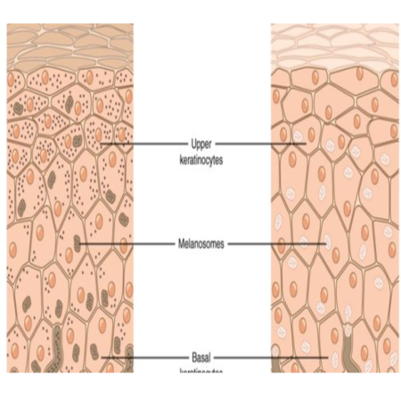 Sắc tố da người